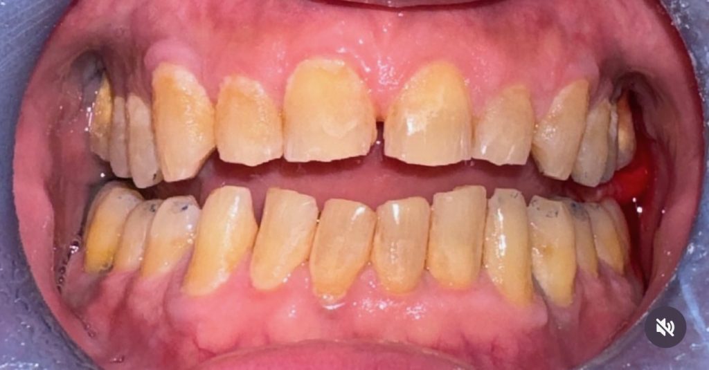 190830717009 - Dental McAllen